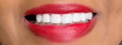 smile gallery image