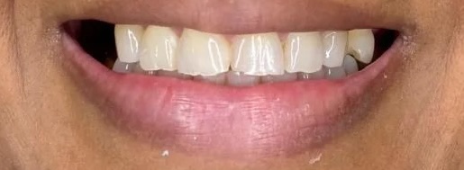 smile gallery image