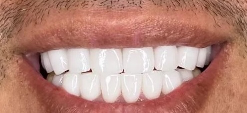 smile gallery image