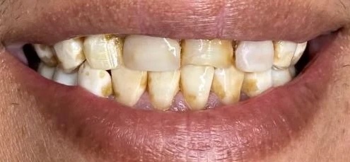smile gallery image