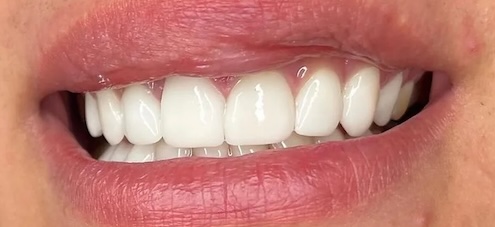 smile gallery image