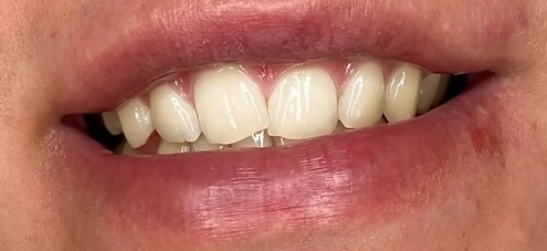 smile gallery image