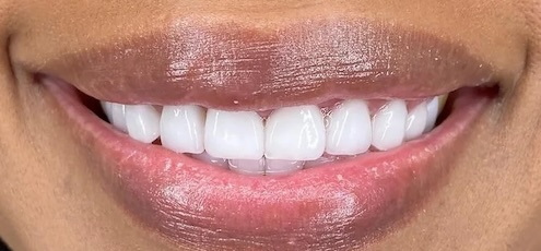 smile gallery image