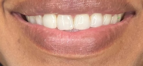 smile gallery image