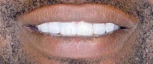 smile gallery image