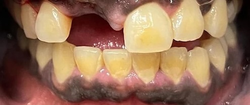 smile gallery image