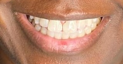 smile gallery image