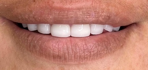 smile gallery image