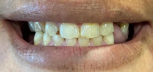 smile gallery image