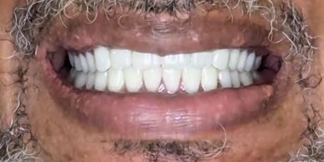 smile gallery image