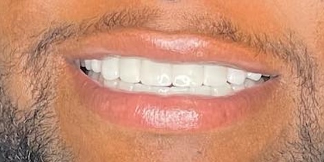 smile gallery image