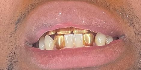 smile gallery image