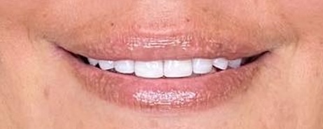 smile gallery image