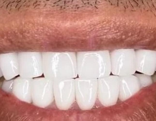 Case 2 after