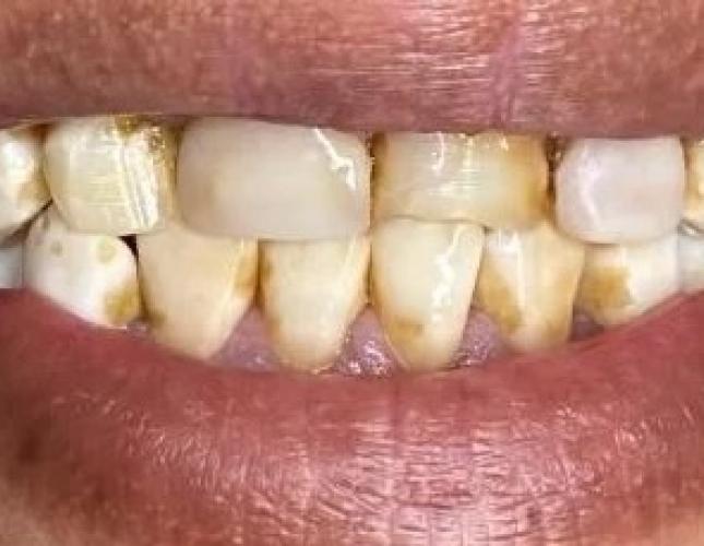 Case 2 before