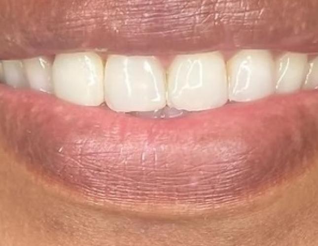 Case 4 before