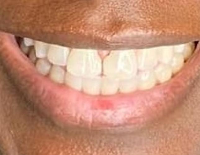 Case 10 before