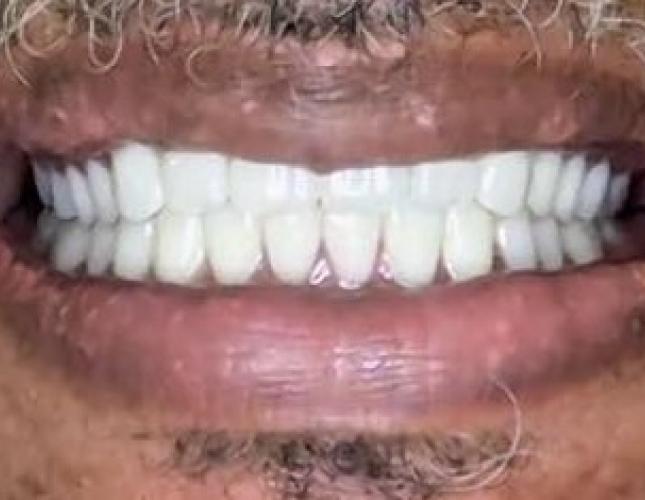 Case 7 after