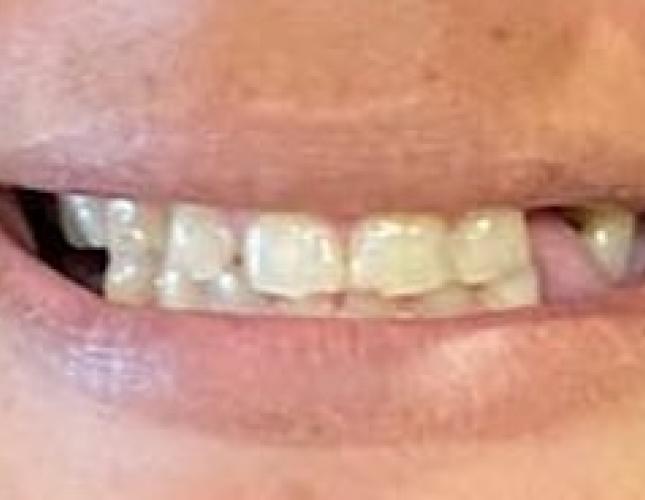 Case 9 before